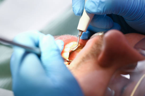 Best Dentist for Severe Toothache  in Venice, IL